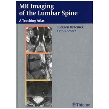 mr imaging of the lumbar spine 腰椎磁共振影像