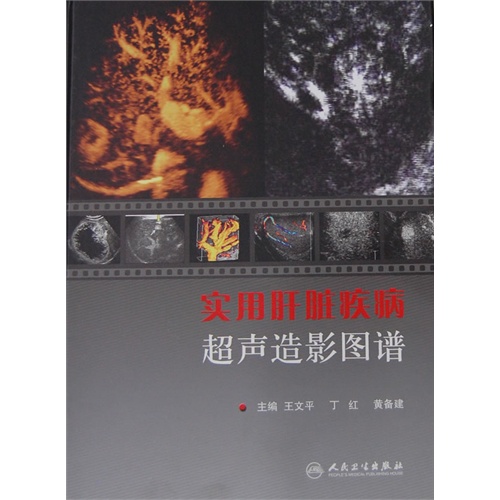 【实用肝脏疾病超声造影图谱图片】高清图_外