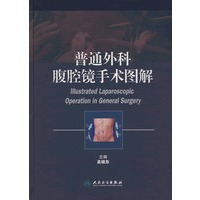 普通外科腹腔镜手术图解
