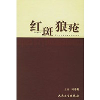 红斑狼疮
