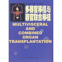 多器官移植与器官联合移植