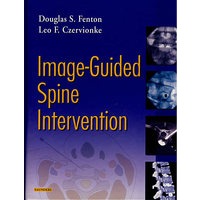 影像指导下的脊柱介入技术Image-Guided Spine Intervention