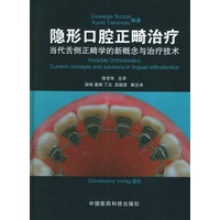 隐形口腔正畸治疗：当代舌侧正畸学的新概念与治疗技术