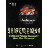 外周血管超声彩色血液成像