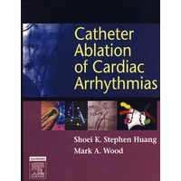 心律不齐导管消融Catheter Ablation of Cardiac Arrhythmias