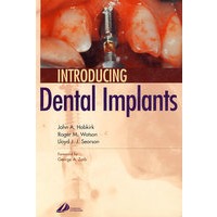 口腔种植导论：Introducing Dental Implants