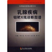 乳腺疾病钼靶X线诊断图谱