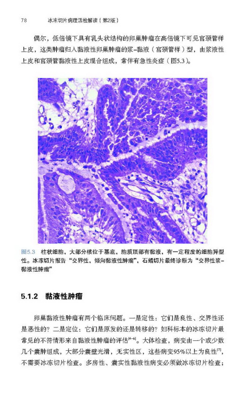 冰冻切片病理活检解读(第2版)-百道网